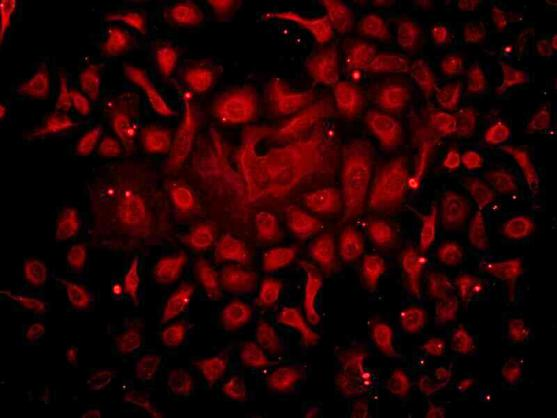 Anti-DNA-RNA Hybrid [S9.6] Antibody